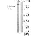 Western blot analysis of extracts from HeLa cells, using ZNF337 antibody.