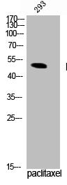 Western Blot analysis of 293 cells using Phospho-TPH1 (S58) Polyclonal Antibody