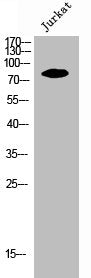 Western Blot analysis of Jurkat cells using Ezrin Polyclonal Antibody