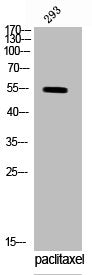 Western Blot analysis of 293 cells using Phospho-Vimentin (S83) Polyclonal Antibody