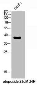 Western Blot analysis of HuvEc etoposide 25uM 24H cells using Phospho-Fusin (S339) Polyclonal Antibody
