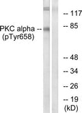 Western blot analysis of extracts from COLO205 cells using PKC α (Phospho-Tyr658) Antibody.The lane on the right is treated with the antigen-specific peptide.