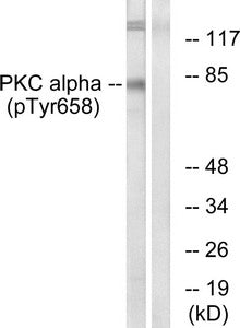 Western blot analysis of extracts from COLO205 cells using PKC α (Phospho-Tyr658) Antibody.The lane on the right is treated with the antigen-specific peptide.