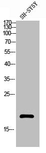 Western blot analysis of SH-SY5Y lysis using Acetyl-Histone H3 (K18) antibody.
