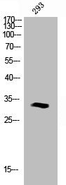 Western Blot analysis of Jurkat cells using Phospho-Caspase-6 (S257) Polyclonal Antibody
