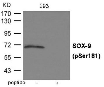 Western blot analysis of extracts from 293 cells using SOX-9 (Phospho-Ser181) Antibody.The lane on the right is treated with the antigen-specific peptide.