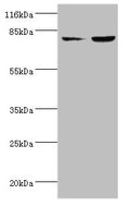 Western blot
All lanes: ACSL4 antibody at 2µg/ml
Lane 1: HepG2 whole cell lysate
Lane 2: Hela whole cell lysate
Secondary
Goat polyclonal to rabbit IgG at 1/10000 dilution
Predicted band size: 80, 75 kDa
Observed band size: 80 kDa