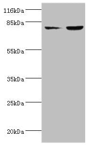 Western blot
All lanes: ACSL4 antibody at 2µg/ml
Lane 1: HepG2 whole cell lysate
Lane 2: Hela whole cell lysate
Secondary
Goat polyclonal to rabbit IgG at 1/10000 dilution
Predicted band size: 80, 75 kDa
Observed band size: 80 kDa