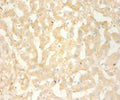 Immunohistochemistry of paraffin-embedded human liver using CSB-PA06139A0Rb at dilution 1:100