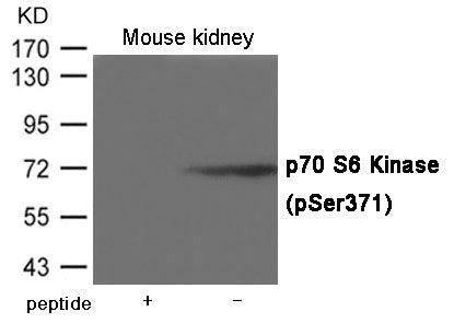 Western blot analysis of extracts from  Mouse kidney tissue using p70 S6 Kinase (Ser371) Antibody.The lane on the left is treated with the antigen-specific peptide.