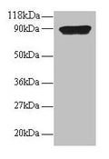 Western blot
All lanes: CXCL5 antibody at 2µg/ml + 293T whole cell lysate
Secondary
Goat polyclonal to rabbit IgG at 1/15000 dilution
Predicted band size: 12 kDa
Observed band size: 90 kDa