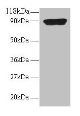 Western blot
All lanes: CXCL5 antibody at 2µg/ml + 293T whole cell lysate
Secondary
Goat polyclonal to rabbit IgG at 1/15000 dilution
Predicted band size: 12 kDa
Observed band size: 90 kDa