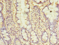 Immunohistochemistry of paraffin-embedded human small intestine tissue using CSB-PA06169A0Rb at dilution of 1:100