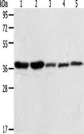 Gel: 10%SDS-PAGE, Lysate: 40 ug, Lane 1-5: A431 cells, NIH/3T3 cells, Hela cells, Jurkat cells, PC3 cells, Primary antibody: CSB-PA061704(ANXA1 Antibody) at dilution 1/400, Secondary antibody: Goat anti rabbit IgG at 1/8000 dilution, Exposure time: 20 seconds