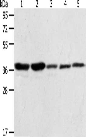 Gel: 10%SDS-PAGE, Lysate: 40 ug, Lane 1-5: A431 cells, NIH/3T3 cells, Hela cells, Jurkat cells, PC3 cells, Primary antibody: CSB-PA061704(ANXA1 Antibody) at dilution 1/400, Secondary antibody: Goat anti rabbit IgG at 1/8000 dilution, Exposure time: 20 seconds
