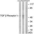 Western blot analysis of extracts from COLO cells and HepG2 cells, using TGF β Receptor I (Ab-165) antibody.