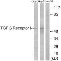 Western blot analysis of extracts from COLO cells and HepG2 cells, using TGF β Receptor I (Ab-165) antibody.