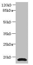 Western blot
All lanes: CST3 antibody at 2µg/ml + Human positive serum
Secondary
Goat polyclonal to rabbit IgG at 1/15000 dilution
Predicted band size: 16 kDa
Observed band size: 16 kDa