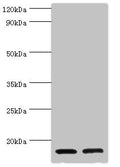 Western blot
All lanes: CST3 antibody at 2µg/ml
Lane 1: High values of serum at 1: 10
Lane 2: High values of serum at 1: 100
Secondary
Goat polyclonal to rabbit IgG at 1/10000 dilution
Predicted band size: 16 kDa
Observed band size: 16 kDa