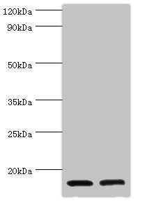 Western blot
All lanes: CST3 antibody at 2µg/ml
Lane 1: High values of serum at 1: 10
Lane 2: High values of serum at 1: 100
Secondary
Goat polyclonal to rabbit IgG at 1/10000 dilution
Predicted band size: 16 kDa
Observed band size: 16 kDa