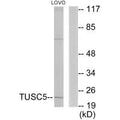 Western blot analysis of extracts from LOVO cells, using TUSC5 antibody.