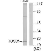 Western blot analysis of extracts from LOVO cells, using TUSC5 antibody.