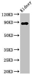 Western Blot
Positive WB detected in: Rat kidney tissue
All lanes: DPP4 antibody at 2.8ug/ml
Secondary
Goat polyclonal to rabbit IgG at 1/50000 dilution
Predicted band size: 89 kDa
Observed band size: 89 kDa