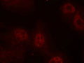 Immunofluorescence staining of methanol-fixed Hela cells using Myc(Phospho-Ser62) Antibody.