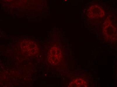 Immunofluorescence staining of methanol-fixed Hela cells using Myc(Phospho-Ser62) Antibody.