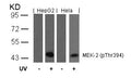 Western blot analysis of extracts from HepG2 and Hela cells untreated or treated with UV using MEK-2(Phospho-Thr394) Antibody.