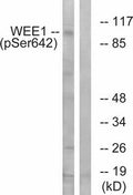 Western blot analysis of extracts from 293 cells treated with etoposide using WEE1 (Phospho-Ser642) Antibody.The lane on the right is treated with the antigen-specific peptide.