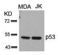 Western blot analysis of extracts from MDA and JK cells using p53(Ab-15) Antibody.