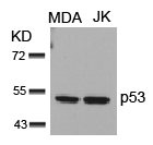Western blot analysis of extracts from MDA and JK cells using p53(Ab-15) Antibody.