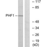 Western blot analysis of extracts from HeLa cells, using PHF1 antibody.