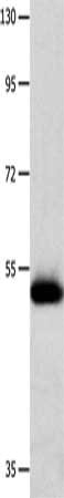 Gel: 8%SDS-PAGE, Lysate: 40 ug, Lane: Human endometrial carcinoma tissue, Primary antibody: CSB-PA063512(MMP10 Antibody) at dilution 1/200, Secondary antibody: Goat anti rabbit IgG at 1/8000 dilution, Exposure time: 1 minute