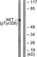 Western blot analysis of extracts from mouse liver cells, using Akt (Phospho-Tyr326) antibody. The lane on the right is treated with the synthesized peptide.
