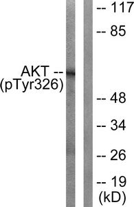 Western blot analysis of extracts from mouse liver cells, using Akt (Phospho-Tyr326) antibody. The lane on the right is treated with the synthesized peptide.