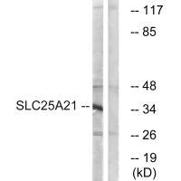 Western blot analysis of extracts from HepG2 cells, using SLC25A21 antibody.