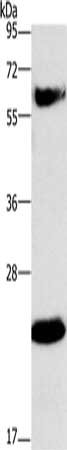Gel: 10%SDS-PAGE, Lysate: 40 ug, Lane: Human fetal liver tissue, Primary antibody: CSB-PA063887(GGT1 Antibody) at dilution 1/350, Secondary antibody: Goat anti rabbit IgG at 1/8000 dilution, Exposure time: 40 seconds