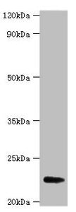 Western blot
All lanes: FGF21 antibody at 2µg/ml + A549 whole cell lysate
Secondary
Goat polyclonal to rabbit IgG at 1/15000 dilution
Predicted band size: 23 kDa
Observed band size: 23 kDa