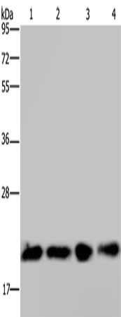 Gel: 10%SDS-PAGE, Lysate: 30 ug, Lane 1-4: Hela cells, HepG2 cells, 231 cells, Mouse kidney tissue, Primary antibody: CSB-PA064824(HRAS Antibody) at dilution 1/200, Secondary antibody: Goat anti rabbit IgG at 1/8000 dilution, Exposure time: 30 seconds