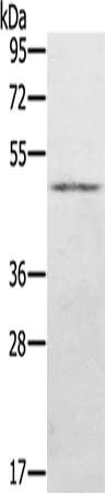 Gel: 8%SDS-PAGE, Lysate: 40 ug, Lane: Human normal stomach tissue, Primary antibody: CSB-PA064874(KDM8 Antibody) at dilution 1/500, Secondary antibody: Goat anti rabbit IgG at 1/8000 dilution, Exposure time: 3 minutes