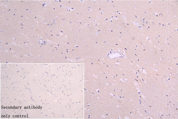IFNA2 Antibody