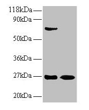 Western blot
All lanes: IFNG antibody at 2µg/ml
Lane 1: EC109 whole cell lysate
Lane 2: 293T whole cell lysate
Secondary
Goat polyclonal to rabbit IgG at 1/15000 dilution
Predicted band size: 20 kDa
Observed band size: 27 kDa