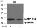 Western blot analysis of extracts from 293 cells untreated or treated with H2O2 using hnRNP C1/2 (Phospho-Ser260) Antibody .