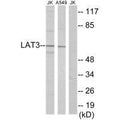 Western blot analysis of extracts from Jurkat cells and A549 cells, using LAT3 antibody.