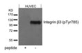 Western blot analysis of extracts from HUVEC cells using Integrin b3(Phospho-Tyr785) Antibody and the same antibody preincubated with blocking peptide .