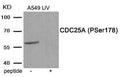Western blot analysis of extracts from A549 cells treated with UV  using Phospho-CDC25A (Ser178) antibody.The lane on the right is treated with the antigen-specific peptide.