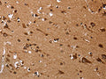 The image on the left is immunohistochemistry of paraffin-embedded Human brain tissue using CSB-PA066402(EDN3 Antibody) at dilution 1/50, on the right is treated with fusion protein. (Original magnification: ×200)