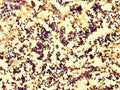 Immunohistochemistry of paraffin-embedded human appendix tissue using CSB-PA06659A0Rb at dilution of 1:100